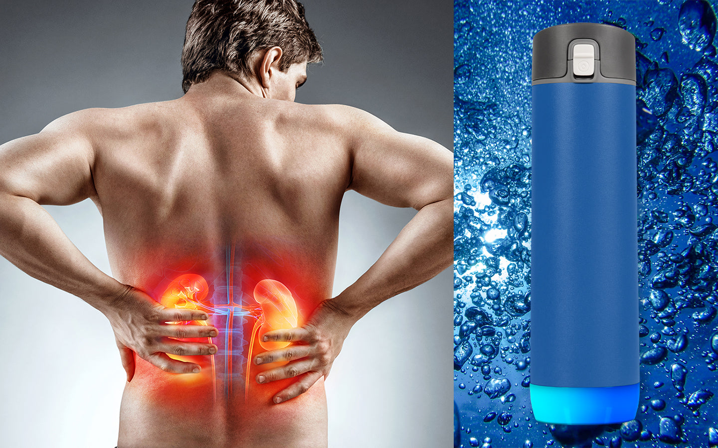 Study Documents the Prevention of Urinary Stones Through Hydration via HidrateSpark