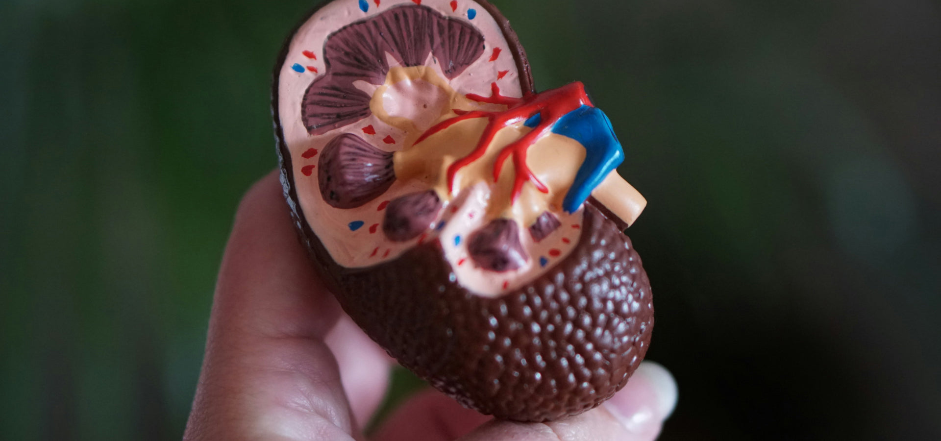 Does Staying Hydrated Prevent Kidney Stones?